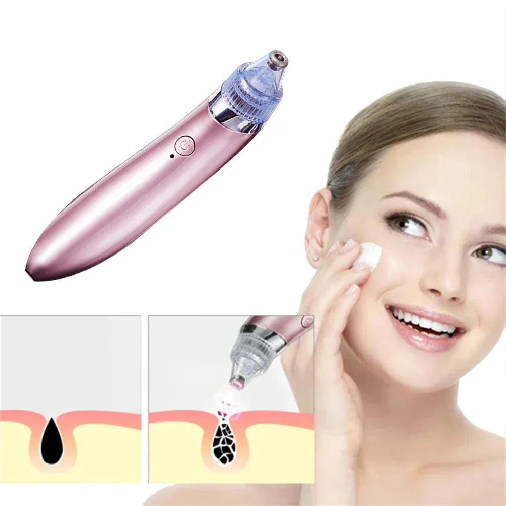 Multifunctional 4 in 1 Beauty Pore Vacuum