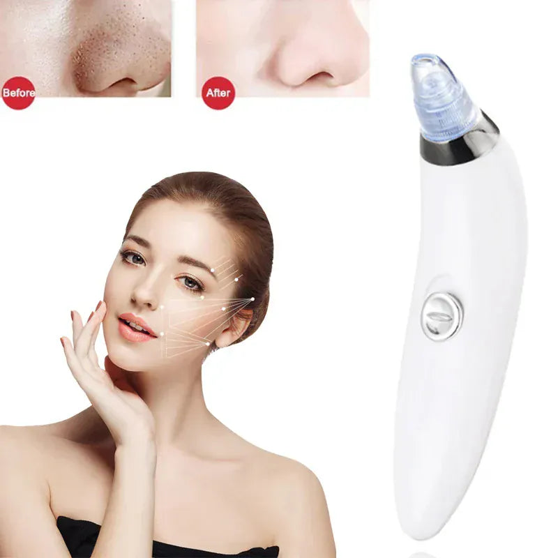 Multifunctional 4 in 1 Beauty Pore Vacuum