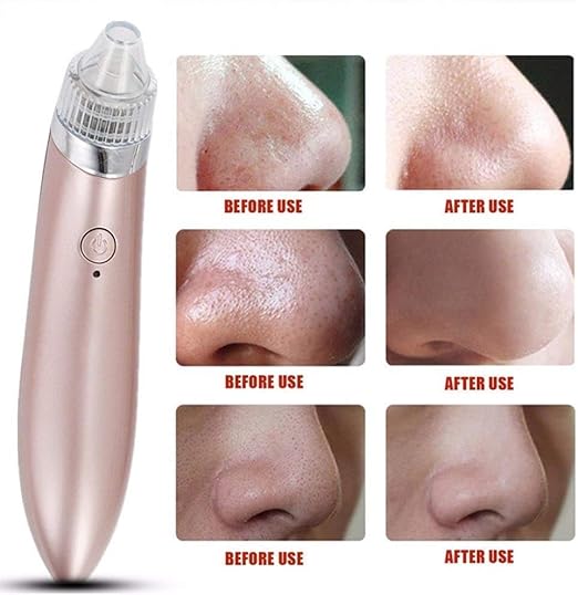 Multifunctional 4 in 1 Beauty Pore Vacuum