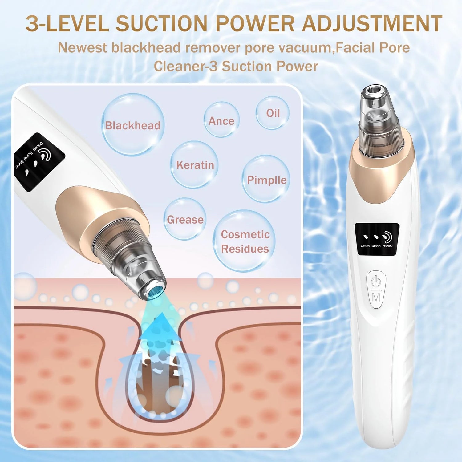 Blackhead Remover Vacuum Pore Extractor Kit - Blackhead Extractor Tool with 3 Adjustable Suction Levels, 5 Probes, USB Rechargeable, Suitable for Women and Men